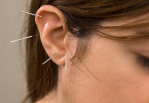 Using Alternative Treatments for Tinnitus Treatment