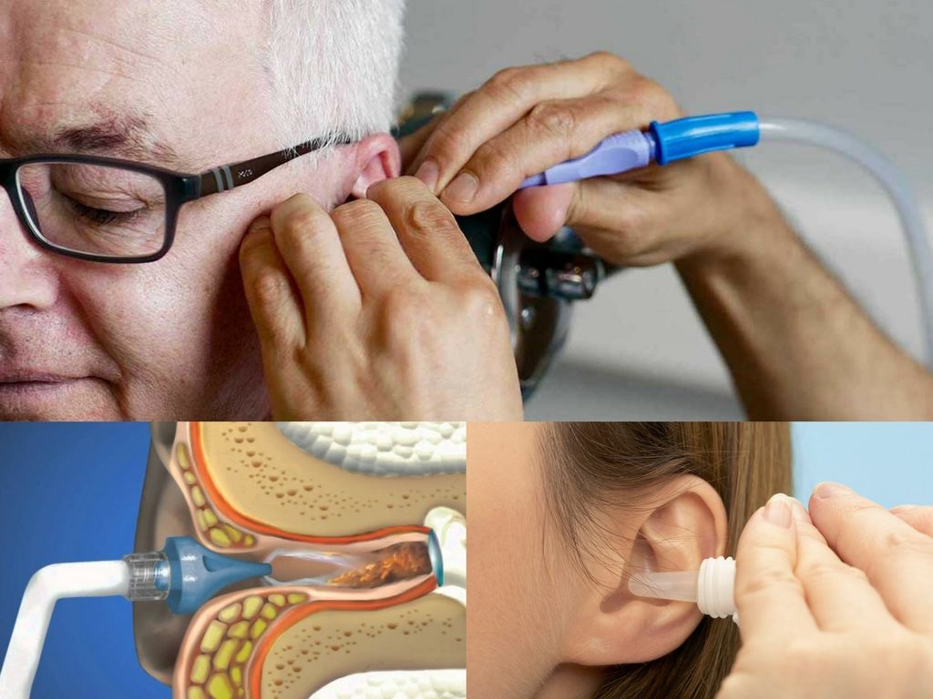 best way to remove ear wax from your ear