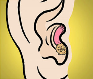 Could Earwax Be Causing Your Tinnitus?